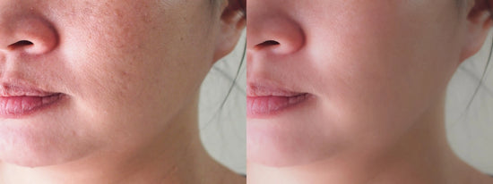 RESCUE ME. Helps heal skin irritations (eczema, rosacea and rash). Relieves itching Sweetwater Labs