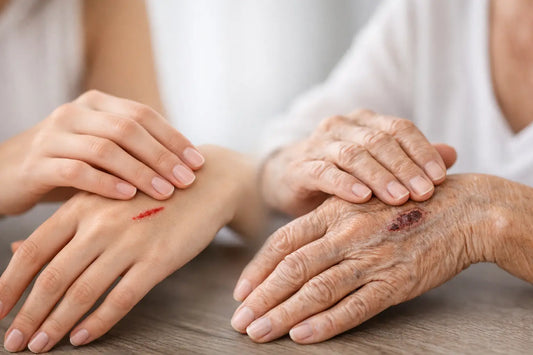 Why Does Skin Heal More Slowly as We Age?